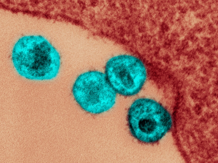 Enlargement of microscopic HIV virus cells 